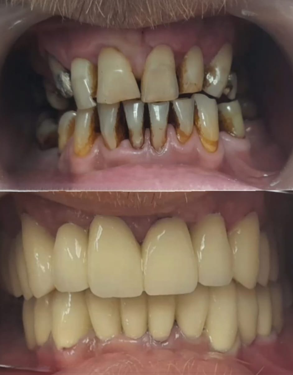 Before and after esthetic treatment