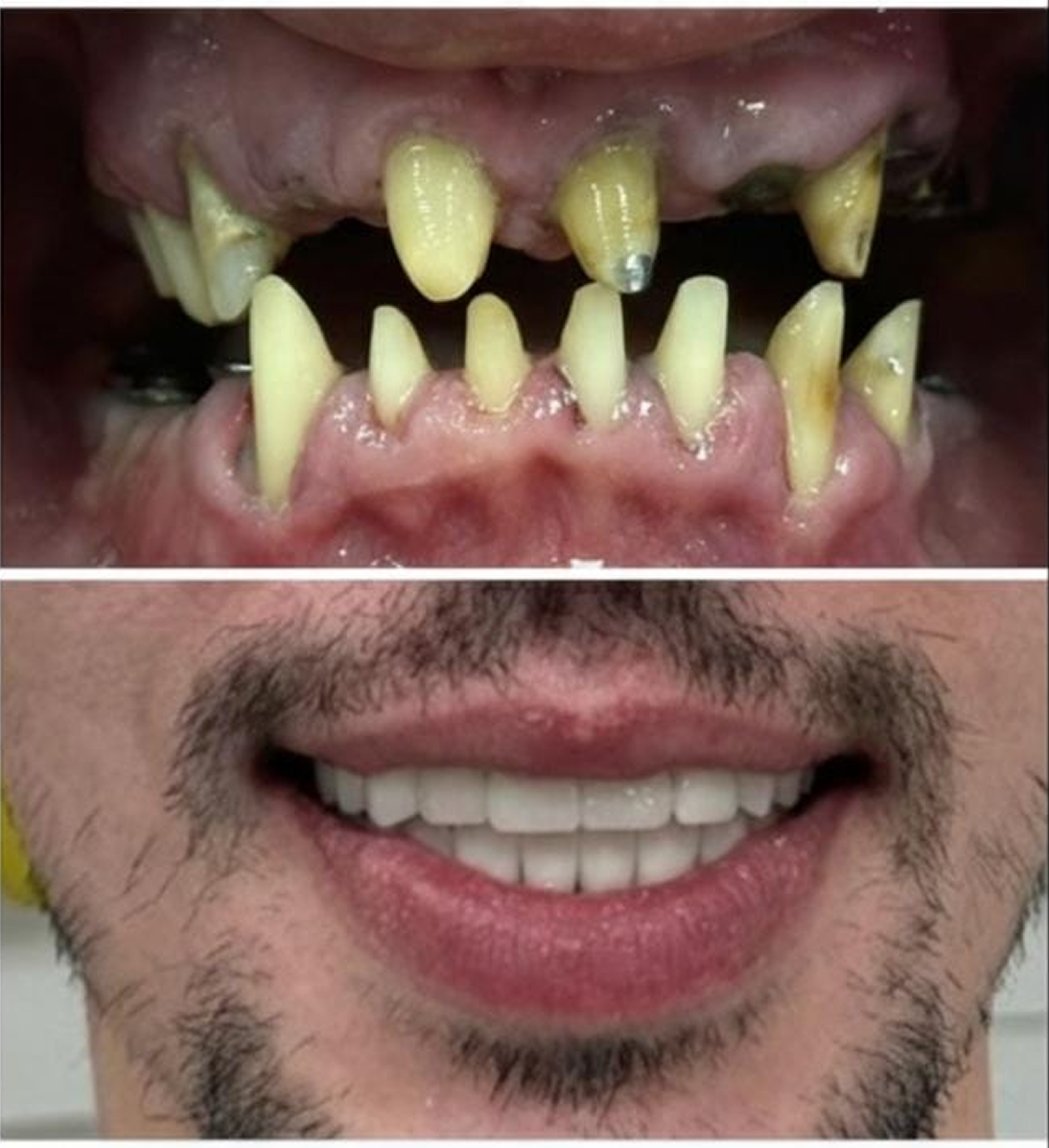 Restorative implantology